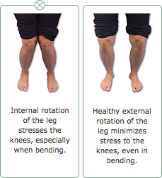 kneepain1