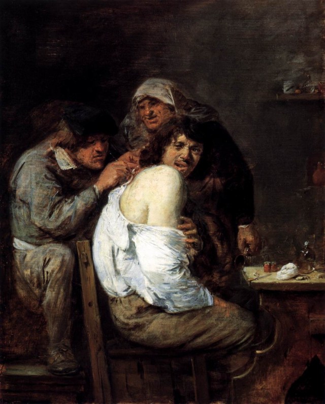 Adriaen Brouwer's 'The Back Operation,' 1636, captures only some of the pain of surgical interventions