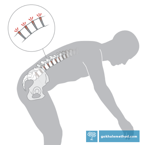 Drawing of a figure round back bending, showing compressive effect on the discs.