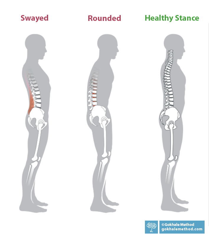 3 diagrams showing standing, side on, with a swayed lower back, tucking the pelvis and rounding, and a healthy stance .