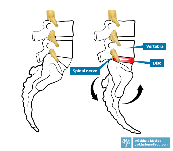 2 diagrams showing L4-5 to sacrum, side on; a healthy L5-S1 angle, versus tucking the pelvis.