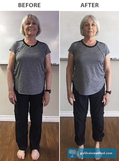 Gokhale Method teacher Karen Walker standing (front view) Before and After, Gokhale Foundations.