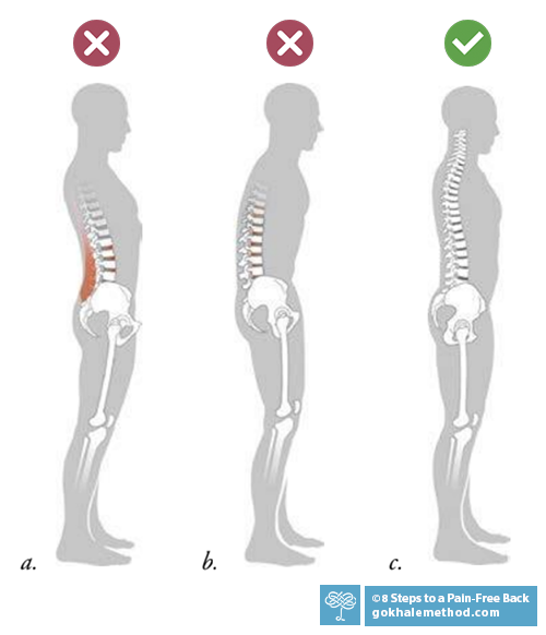 Three drawings showing standing figures in profile: swayed, hunched, and well aligned.
