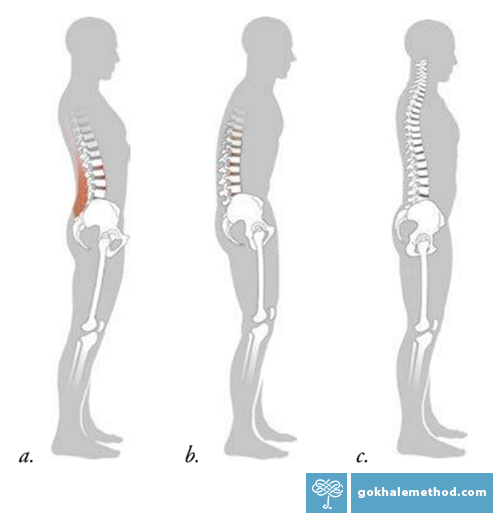 Three drawings showing standing figures in profile: swayed, hunched, and well aligned.