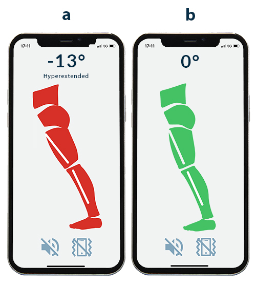 a. PostureTracker™ app showing knee hyperextension. b. PostureTracker™ app showing healthy knee alignment.