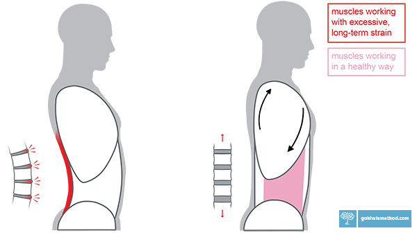 Two diagrams showing swayed to vertical alignment of the torso. 