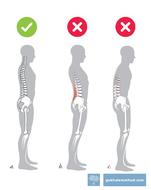 Three standing figures in profile showing anteverted, “neutral”, and tucked pelvis