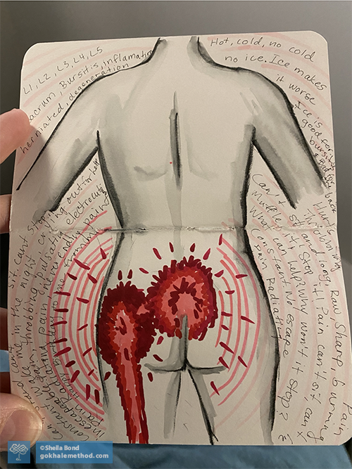Annotated drawing by Sheila Bond indicating red areas of extreme back and hip pain.