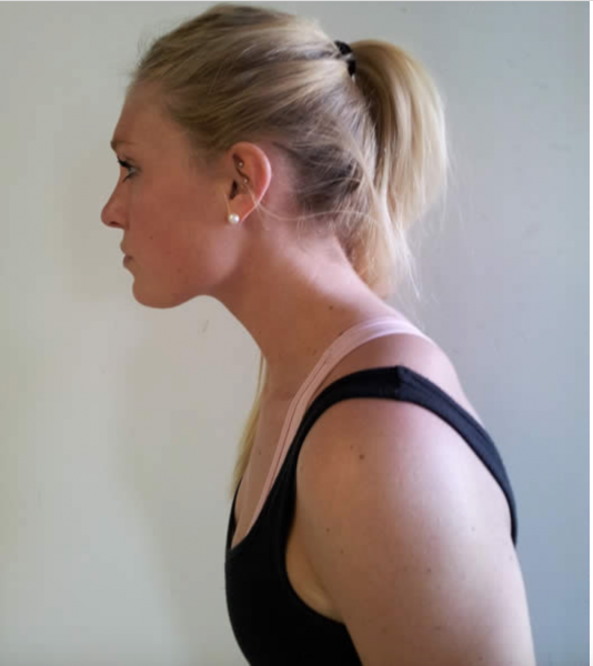 Woman showing forward head posture